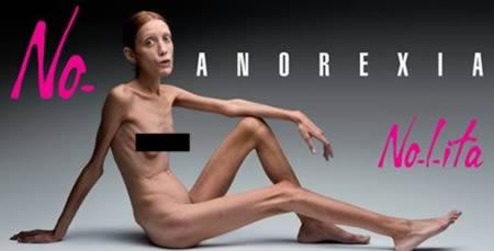 10 самых чудовищных случаев анорексии
