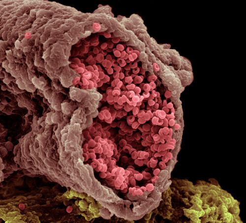 Человеческий организм под микроскопом (17 фото)