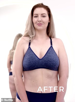 Before and after: Michelle Zamora, 31, was given a mommy makeover on Netflix