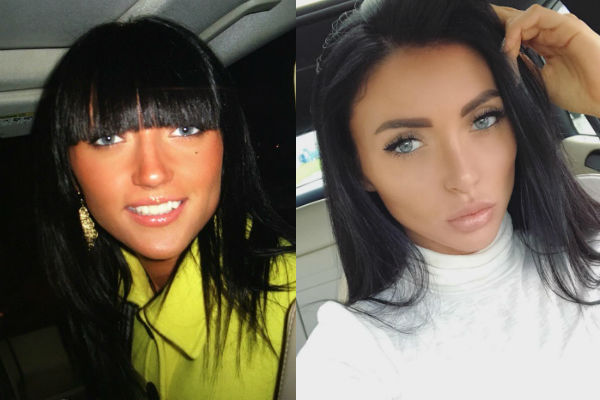 Модель Марина Майер до и после пластических операций на лице фото